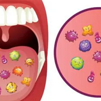 口腔扁平苔藓常见的症状有哪些？
