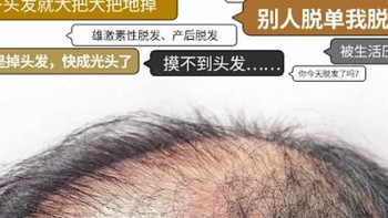 什么牌孑的洗发水可以防脱生发？领先科技，打造坚固秀发防线！