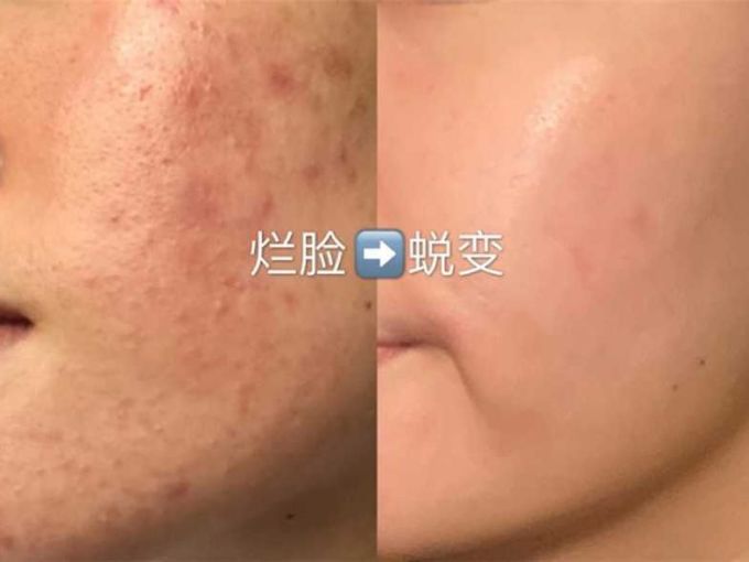 护肤精华