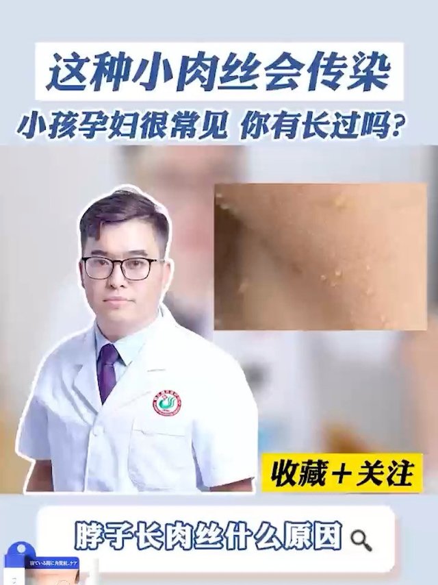 脖子上长有“小啾啾”，不痛不痒的小肉丝，正确做法是这样的！#皮赘 #丝状疣 #小肉粒