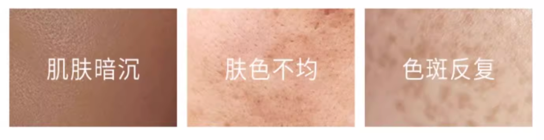 你的黑色素“稳”住了吗?