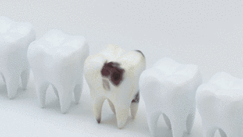 远离那个牙医||资深牙医让你笑着把牙“看”明白了！