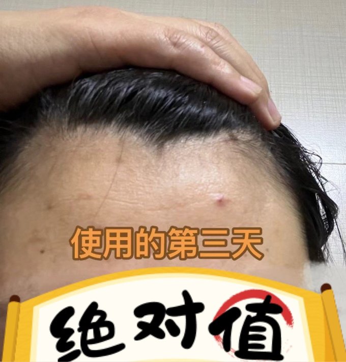 瑷尔博士精华液