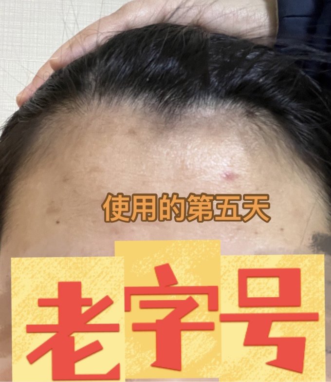 瑷尔博士精华液