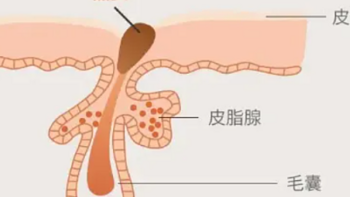 不用手挤，才是去黑头的靠谱方法