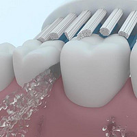 敏感牙齿能用电动牙刷吗？旋转|扫振|声波式隐患分析