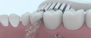 敏感牙齿能用电动牙刷吗？旋转|扫振|声波式隐患分析