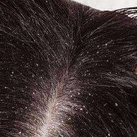 如何改善头发发质？揭露13大头皮发质易损的最直接原因