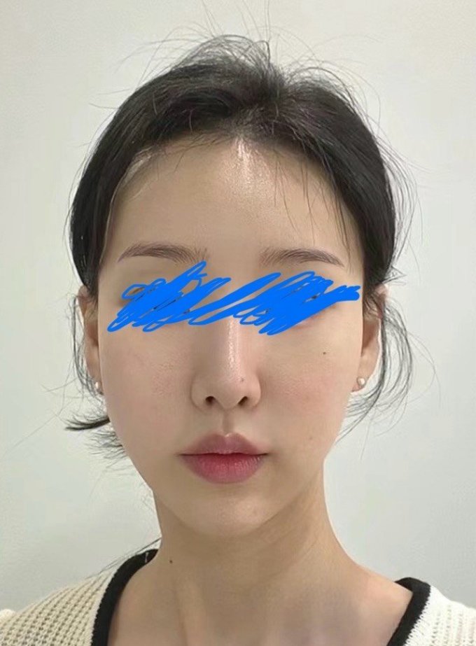 面部皮肤管理