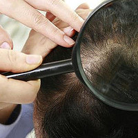 掉头发严重是什么原因女性？4大禁忌隐患千万别中招！