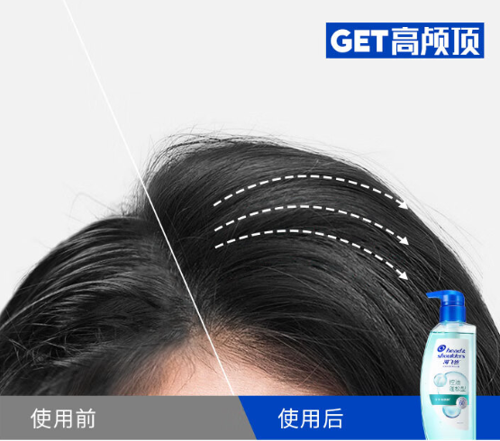 用这个方法让你头发不易出油！头皮敏感、油扁塌、头屑头痒也能得到解决~