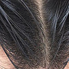 “头”等大事 篇十三：用这个方法让你头发不易出油！头皮敏感、油扁塌、头屑头痒也能得到解决~
