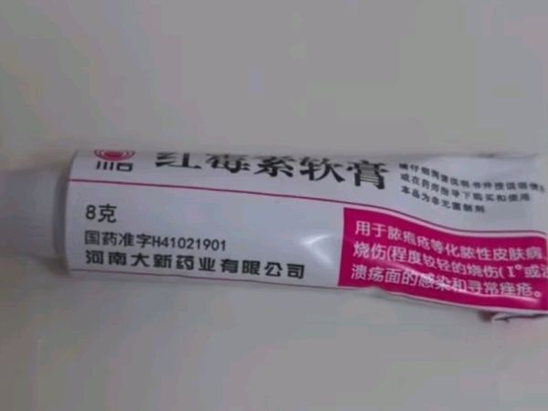 川石 红霉素软膏 消炎抗菌止痒脓疱疮痤疮化脓溃疡感染皮肤病烧伤感染药膏异维A酸凝胶红霉素乳膏