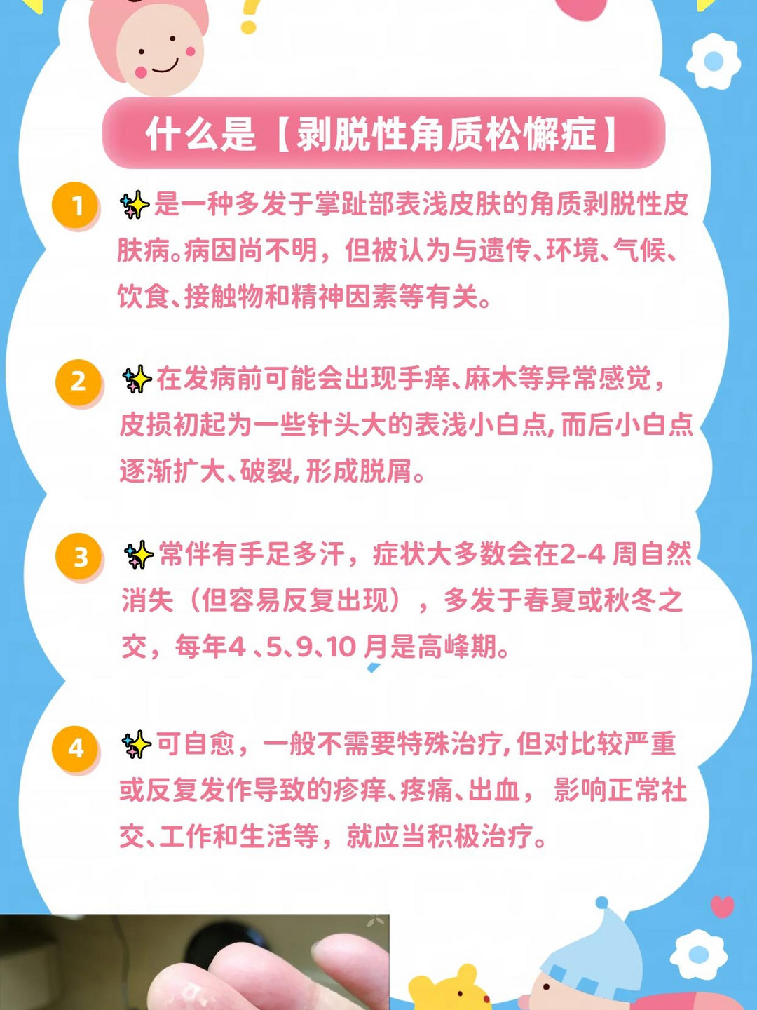 手上起小碎皮怎么回事图片