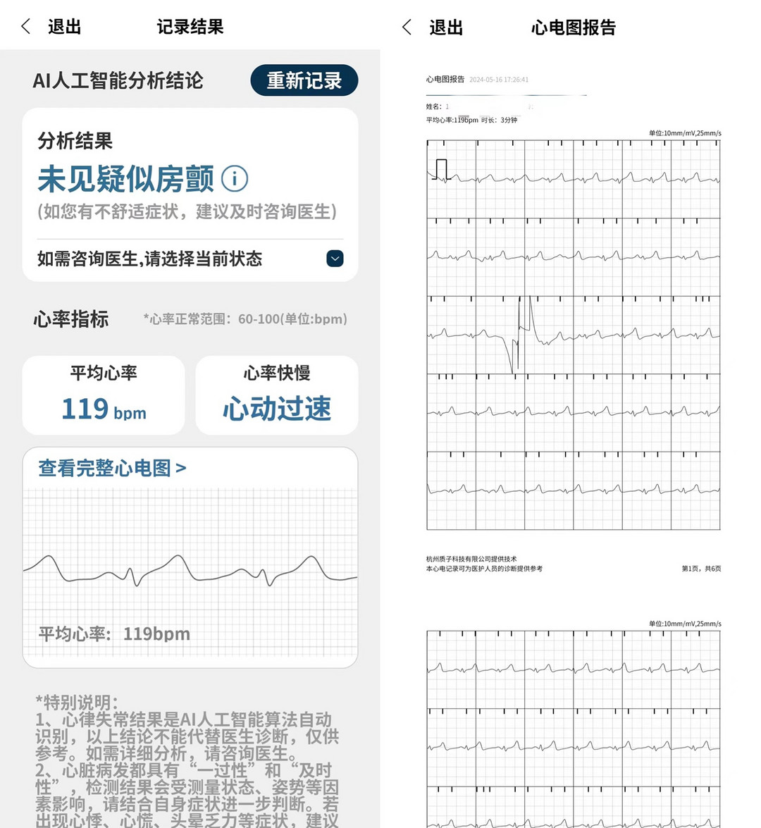 20+因为心脏不适进医院了！奉劝年轻人千万不要再熬夜了