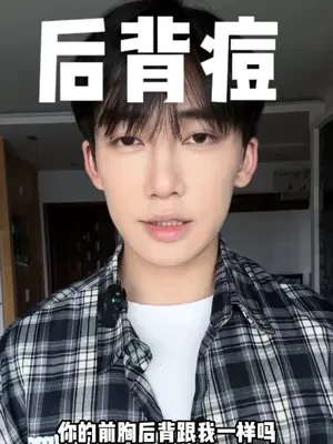 夏天到了！前胸后背爱长痘的阿妹！！不许错过这期