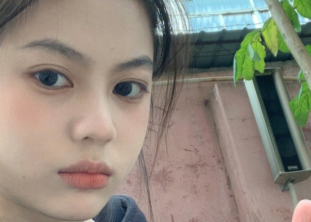 有没有什么好用的祛痘药水推荐？