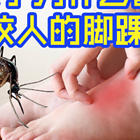 夏日无忧：精选驱蚊神器，守护全家远离蚊虫困扰