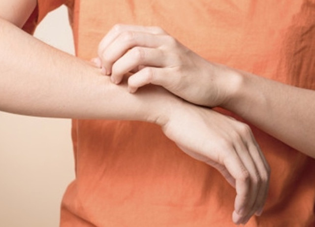 为啥被蚊子咬后越挠越痒？如何快速止痒？