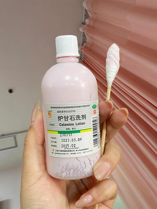 第一次感受到炉甘石对关节黑的鲨伤力。
