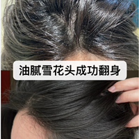 女生控油去屑止痒洗发水哪款好？【头屑产品实际使用体验分享】