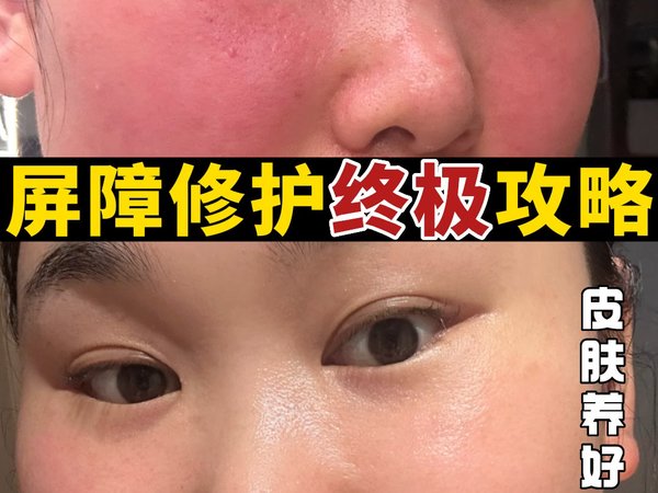 震惊‼️屏障修护终极攻略✅彻底摆脱敏感肌🥰