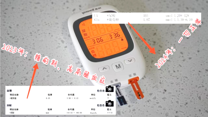 鱼跃血糖仪