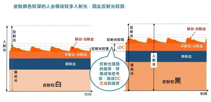 智能手表