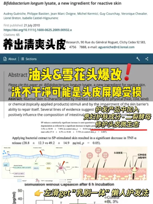 常给头皮做SPA，甩开油头头屑易如反掌！