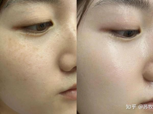 怎么可以淡斑啊？