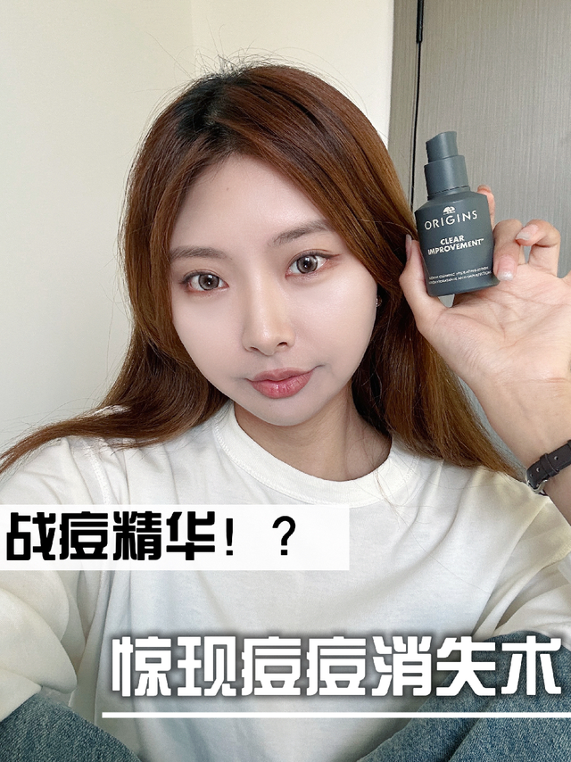 战痘可别乱用！这才是有效祛痘的正确打开方式