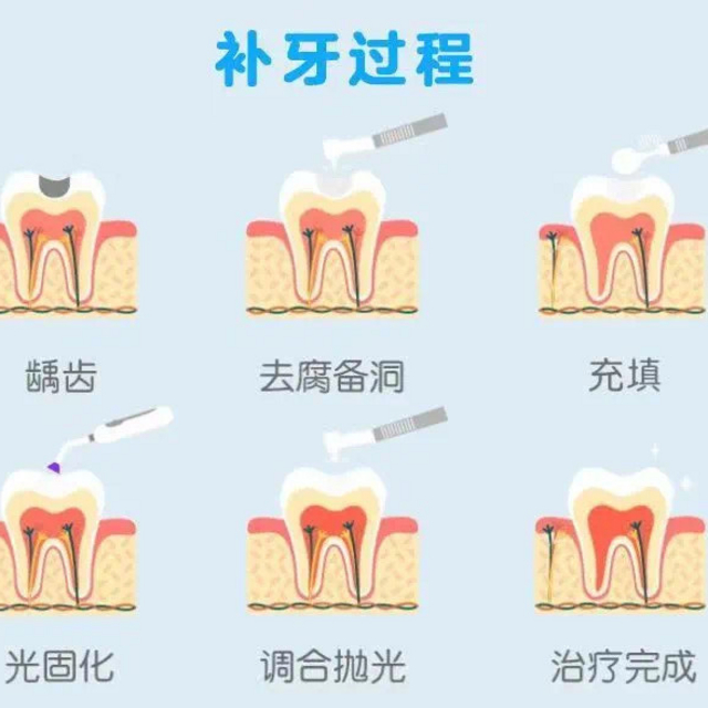 补牙看这篇，再也不怕踩坑！