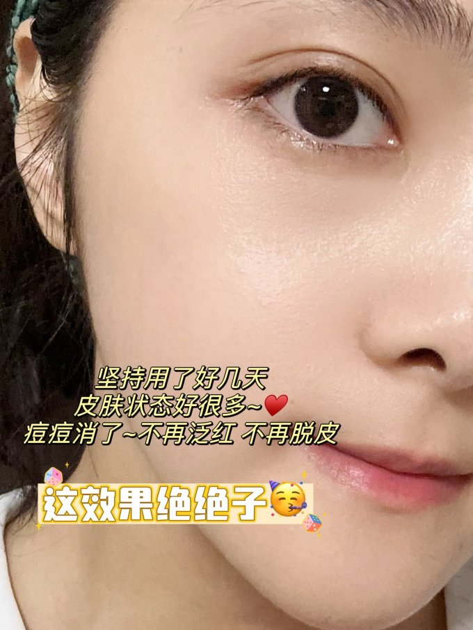 敷尔佳面膜面贴