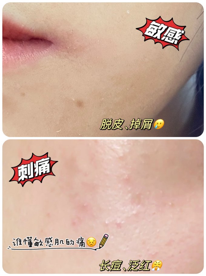 敷尔佳面膜面贴