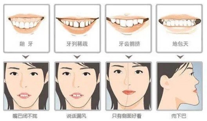 牙齿矫正