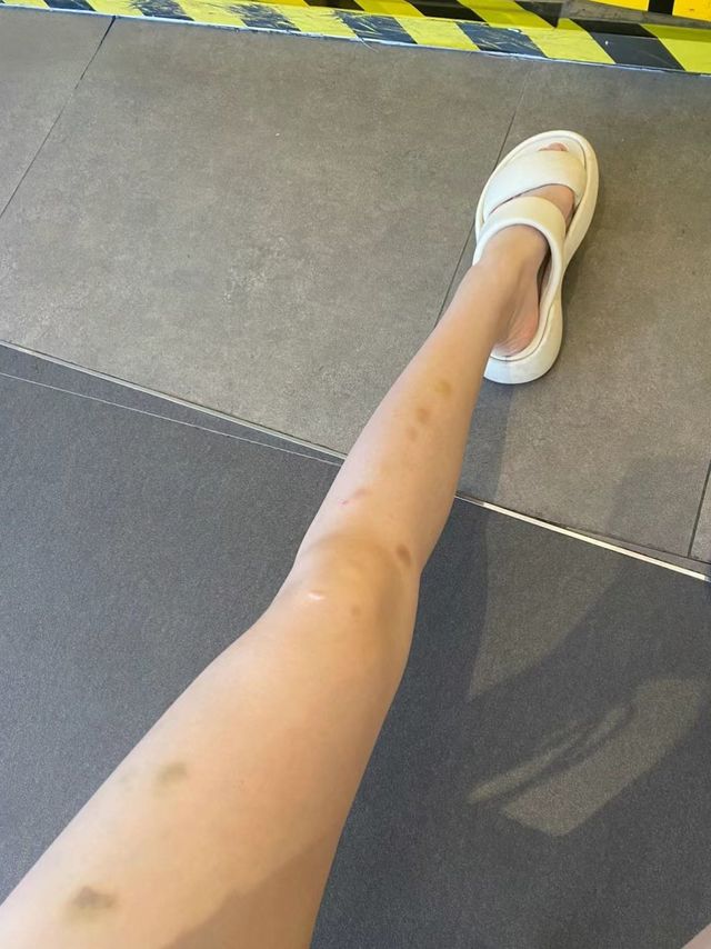 吃eve止疼药反应太大，被司百得布洛芬震撼