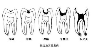 警惕！为什么这么多人牙齿有问题？这些毛病不要再犯！