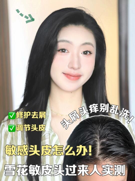 反复头痒又飞屑⁉️咱听劝敏感头洗发水别乱用