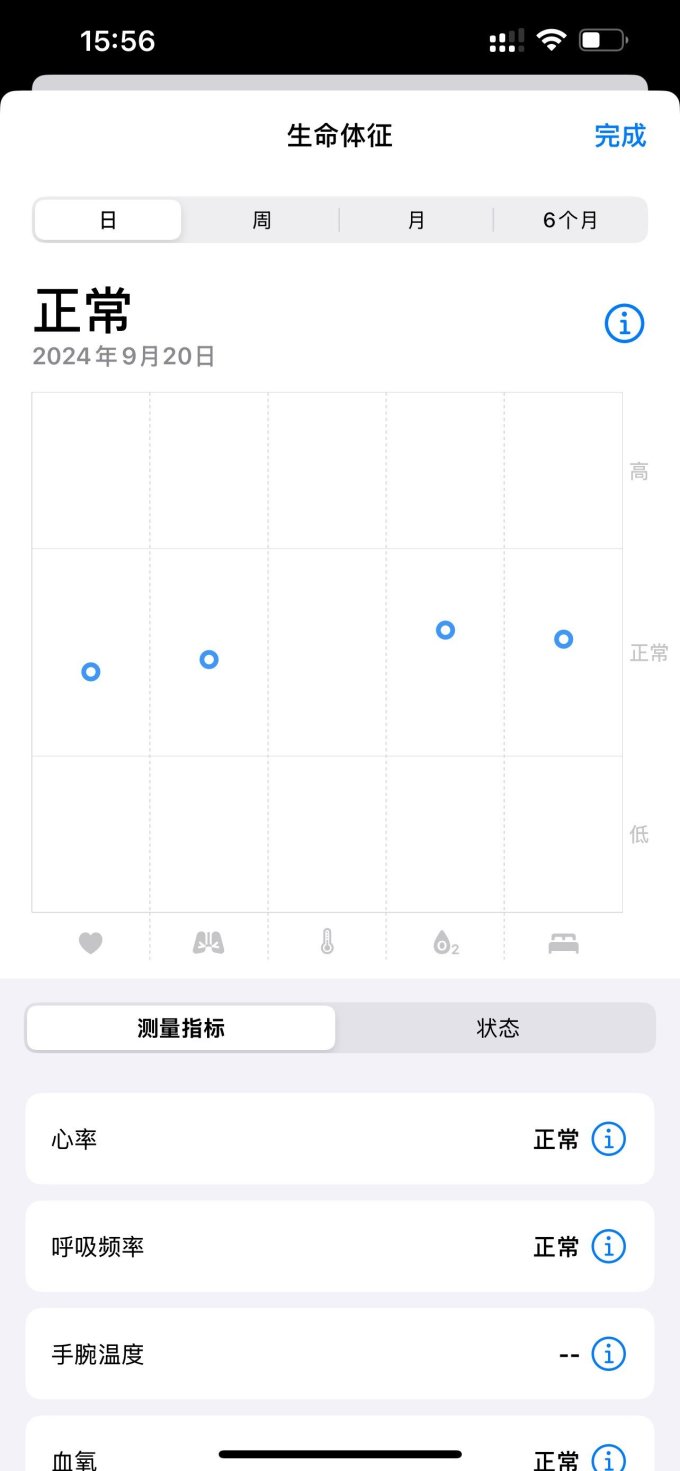 苹果智能手表