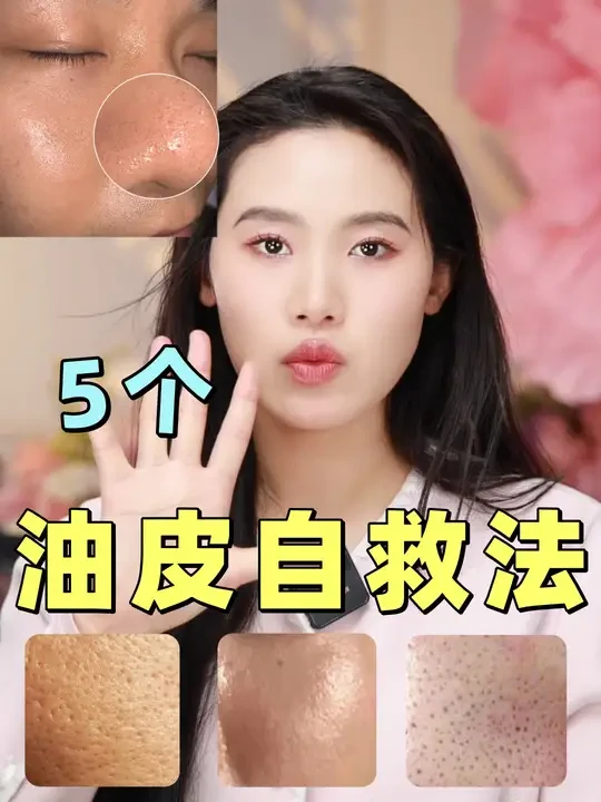 毛孔粗大、出油、长痘、泛红的油皮夏季自救！掌握这5点就够了 #变美小技巧 #皮肤保养 #敏感肌 #女生必看