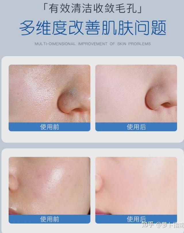 如何通过日常护肤减少黑头产生？