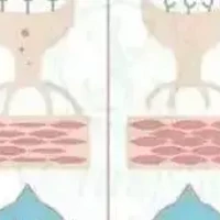 六肽-2Hexapeptide-2|促进胶原蛋白合成，延缓衰老