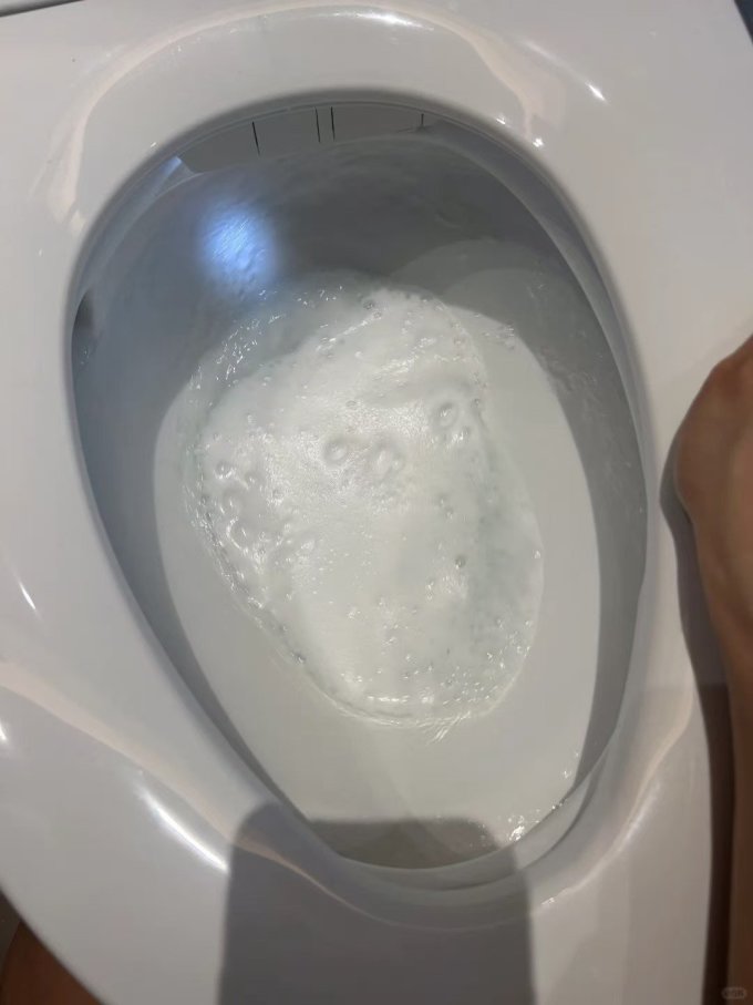 智能马桶