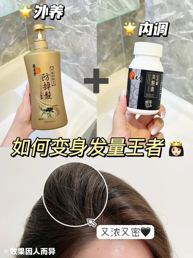 脱发自救成功！我也能拥有氛围感高颅顶了
