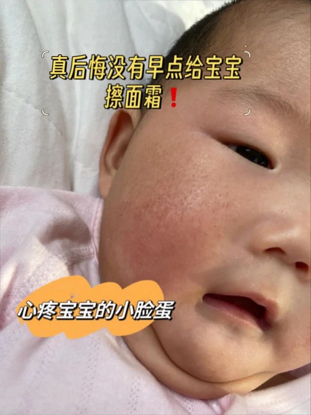 澳兰黛益生元面霜✌️
