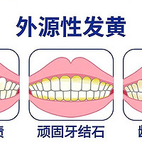 拒绝微笑一口大黄牙！牙黄自救指南看过来！