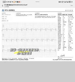 华为最新的测血压手表watch d2准不准