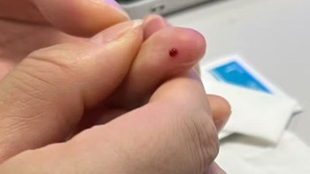 不是...正常人血糖好成这样？ 