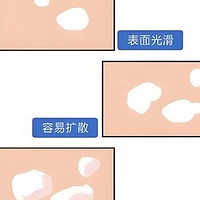 儿童白癜风使用芦可替尼乳膏治疗的疗效、安全性