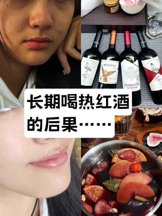 打工人熬夜气色差，频繁喝热红酒之后
